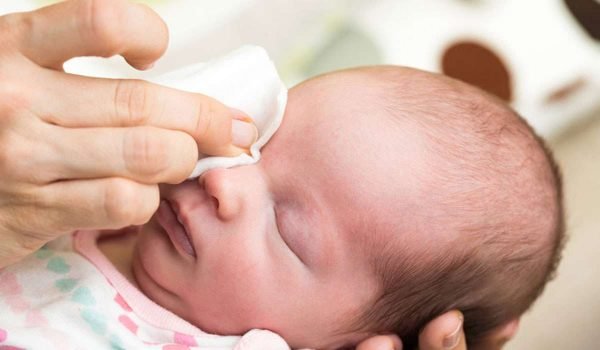 أسباب إفرازات العين عند الأطفال الرضع