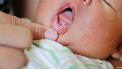 صورة أعراض وأسباب فطريات الفم عند الأطفال الرضع