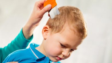 صورة طرق علاج قمل شعر الأطفال في المنزل