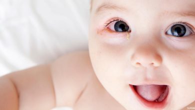 صورة أسباب احمرار العيون عند الأطفال وطرق العلاج