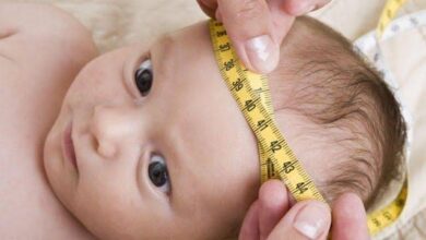 صورة أسباب ضخامة الرأس عند الأطفال الرضع